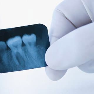 Dental x-ray of teeth held in a gloved hand